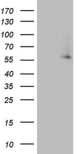 IKZF3 Monoclonal Antibody (OTI1E1), TrueMAB , OriGene 100 &mu;L; Unconjugated:Antibodies,