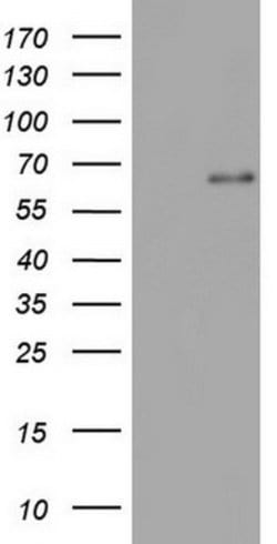 IKZF3 Mouse anti-Human, Clone: OTI2B9, lyophilized, TrueMAB 100 &mu;g;