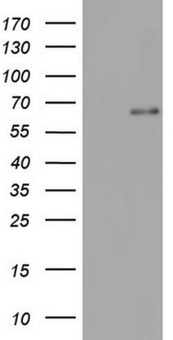 IKZF3 Monoclonal Antibody (OTI2B9), TrueMAB , OriGene 100 &mu;L; Unconjugated:Antibodies,