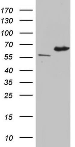 IKZF3 Monoclonal Antibody (OTI5E2), TrueMAB , OriGene 100 &mu;L; Unconjugated:Antibodies,