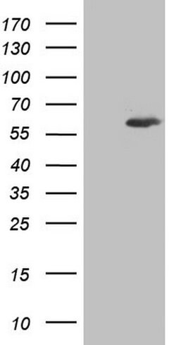 IKZF3 Mouse anti-Human, Clone: OTI7E11, lyophilized, TrueMAB 100 &mu;g;