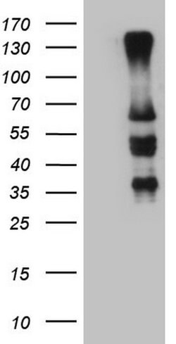 IKZF3 Mouse anti-Human, Clone: OTI4H7, lyophilized, TrueMAB 100 &mu;g;