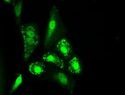 IL-3 Mouse anti-Human, Clone: OTI3B11, lyophilized, TrueMAB 100 &mu;g;