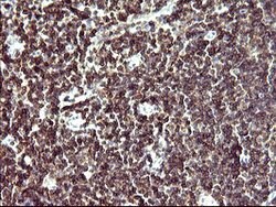 IL10RA Mouse anti-Human, Clone: OTI1D10, lyophilized, TrueMAB 100 &mu;g;