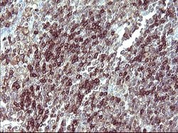 IL10RA Mouse anti-Human, Clone: OTI1D10, lyophilized, TrueMAB 100 &mu;g;