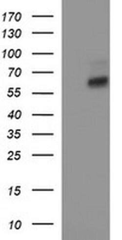 IL10RA Monoclonal Antibody (OTI1E5), TrueMAB , OriGene 30 &mu;L | Buy Online | Origene Technologies | Fisher Scientific