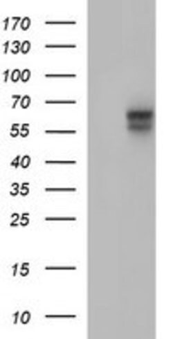 IL10RA Mouse anti-Human, Clone: OTI1D10, lyophilized, TrueMAB 100 &mu;g;