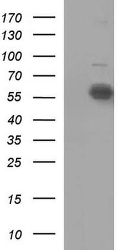 IL10RA Monoclonal Antibody (OTI1C7), TrueMAB , OriGene:Antibodies:Primary