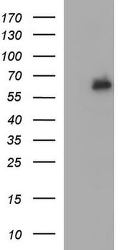 IL10RA Monoclonal Antibody (OTI1D8), TrueMAB , OriGene:Antibodies:Primary