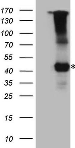 IL12RB1 Monoclonal Antibody (OTI1A6), TrueMAB , OriGene 100 &mu;L; Unconjugated:Antibodies,