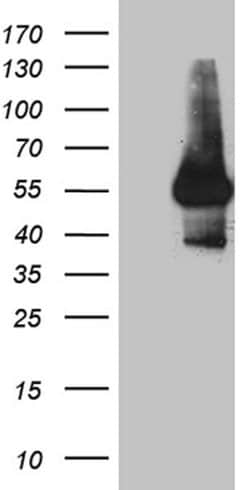 IL15RA Monoclonal Antibody (OTI6B2), TrueMAB , OriGene 30 &mu;L; Unconjugated:Antibodies,