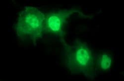 IL1A Mouse anti-Human, Clone: OTI2F11, lyophilized, TrueMAB 100 &mu;g;