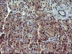 IL1A Mouse anti-Human, Clone: OTI2F11, lyophilized, TrueMAB 100 &mu;g;