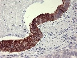 IL1A Mouse anti-Human, Clone: OTI2F11, lyophilized, TrueMAB 100 &mu;g;