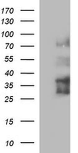 IL1A Monoclonal Antibody (OTI2F11), TrueMAB , OriGene 30 &mu;L; Unconjugated:Antibodies,