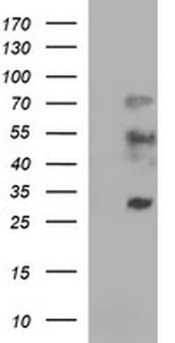 IL1A Mouse anti-Human, Clone: OTI2B4, liquid, TrueMAB 100 &mu;L; Unconjugated:Antibodies,
