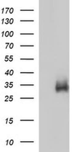 IL1B Monoclonal Antibody (OTI1A7), TrueMAB , OriGene:Antibodies:Primary