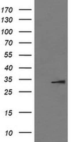 IL1B Mouse anti-Human, Clone: OTI3E1, liquid, TrueMAB 100 &mu;L; Unconjugated:Antibodies,