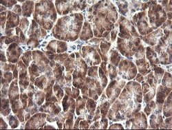 IL1F9 Mouse anti-Human, Clone: OTI6E4, lyophilized, TrueMAB 100 &mu;g;
