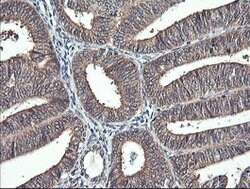 IL1F9 Mouse anti-Human, Clone: OTI6E4, lyophilized, TrueMAB 100 &mu;g;