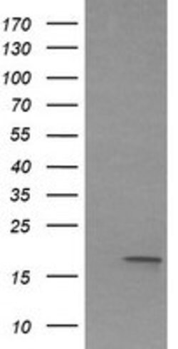 IL1F9 Mouse anti-Human, Clone: OTI6E4, lyophilized, TrueMAB 100 &mu;g;