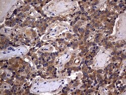 IL1RN Monoclonal Antibody (OTI3B1), TrueMAB , OriGene:Antibodies:Primary