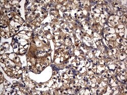 IL1RN Monoclonal Antibody (OTI3B1), TrueMAB , OriGene:Antibodies:Primary