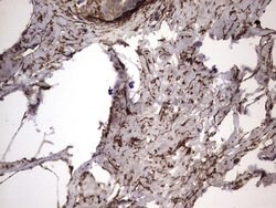 IL1RN Mouse anti-Human, Clone: OTI2B1, lyophilized, TrueMAB 100 &mu;g;