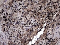 IL1RN Mouse anti-Human, Clone: OTI2B1, lyophilized, TrueMAB 100 &mu;g;