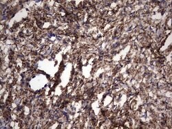 IL1RN Mouse anti-Human, Clone: OTI2B1, lyophilized, TrueMAB 100 &mu;g;