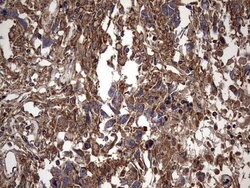 IL1RN Mouse anti-Human, Clone: OTI2B1, lyophilized, TrueMAB 100 &mu;g;