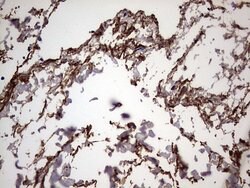 IL1RN Mouse anti-Human, Clone: OTI2B1, lyophilized, TrueMAB 100 &mu;g;