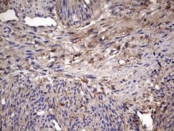 IL1RN Mouse anti-Human, Clone: OTI2B1, lyophilized, TrueMAB 100 &mu;g;