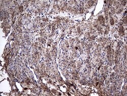 IL1RN Mouse anti-Human, Clone: OTI2B1, lyophilized, TrueMAB 100 &mu;g;