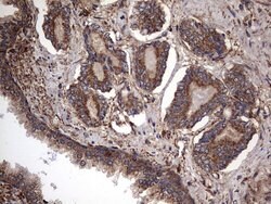 IL1RN Mouse anti-Human, Clone: OTI2B1, lyophilized, TrueMAB 100 &mu;g;