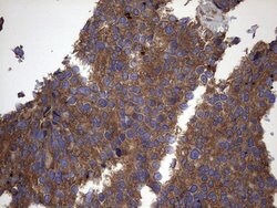 IL1RN Mouse anti-Human, Clone: OTI2B1, lyophilized, TrueMAB 100 &mu;g;