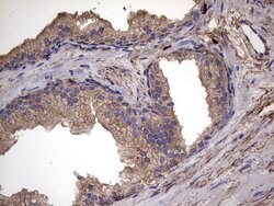 IL1RN Mouse anti-Human, Clone: OTI2B1, lyophilized, TrueMAB 100 &mu;g;