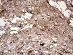 IL1RN Mouse anti-Human, Clone: OTI2B1, lyophilized, TrueMAB 100 &mu;g;