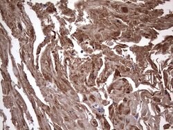 IL1RN Mouse anti-Human, Clone: OTI2B1, lyophilized, TrueMAB 100 &mu;g;