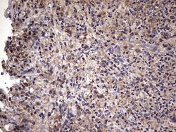 IL1RN Mouse anti-Human, Clone: OTI2B1, lyophilized, TrueMAB 100 &mu;g;