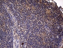 IL1RN Mouse anti-Human, Clone: OTI2B1, lyophilized, TrueMAB 100 &mu;g;