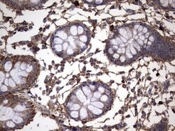 IL1RN Mouse anti-Human, Clone: OTI2B1, lyophilized, TrueMAB 100 &mu;g;