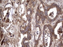 IL1RN Mouse anti-Human, Clone: OTI2B1, lyophilized, TrueMAB 100 &mu;g;
