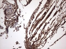IL1RN Mouse anti-Human, Clone: OTI2B1, lyophilized, TrueMAB 100 &mu;g;