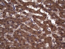 IL1RN Mouse anti-Human, Clone: OTI2B1, lyophilized, TrueMAB 100 &mu;g;
