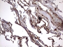 IL1RN Mouse anti-Human, Clone: OTI2B1, lyophilized, TrueMAB 100 &mu;g;