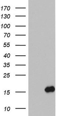 IL1RN Monoclonal Antibody (OTI2D9), TrueMAB , OriGene 100 &mu;L; Unconjugated:Antibodies,