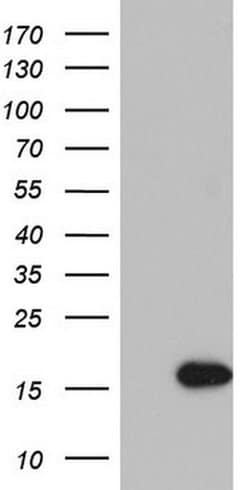 IL1RN Monoclonal Antibody (OTI2D5), TrueMAB , OriGene:Antibodies:Primary
