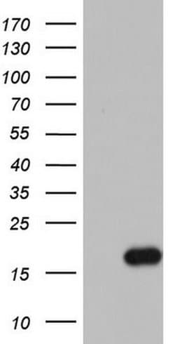 IL1RN Monoclonal Antibody (OTI5C5), TrueMAB , OriGene 100 &mu;L; Unconjugated:Antibodies,