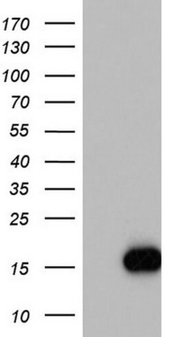 IL1RN Monoclonal Antibody (OTI3B1), TrueMAB , OriGene 100 &mu;L; Unconjugated:Antibodies,